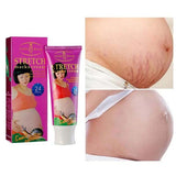 Aichun Beauty Stretch Mark Cream with Snail Extract